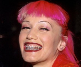 gwen stefani braces
